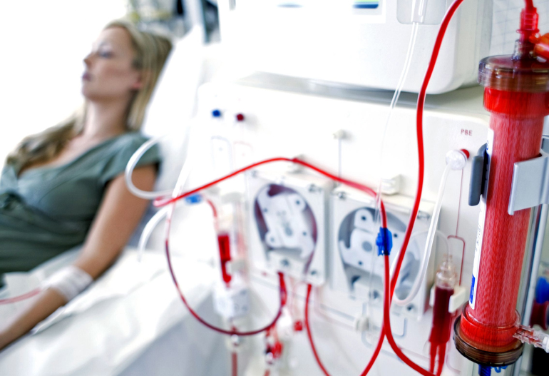 what-is-the-importance-of-dialysis