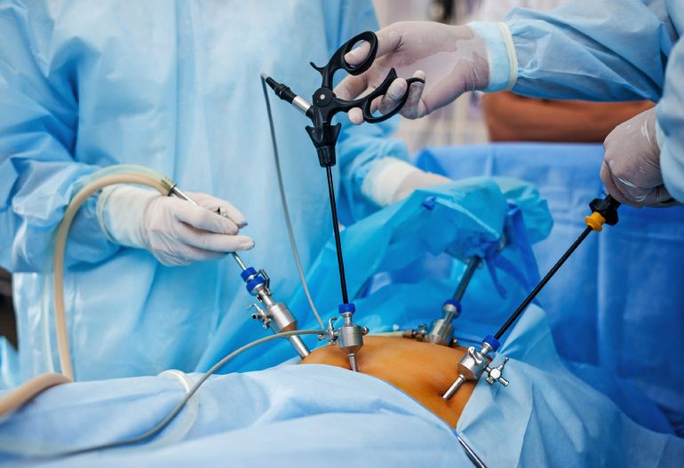 laparoscopic surgery in Solan